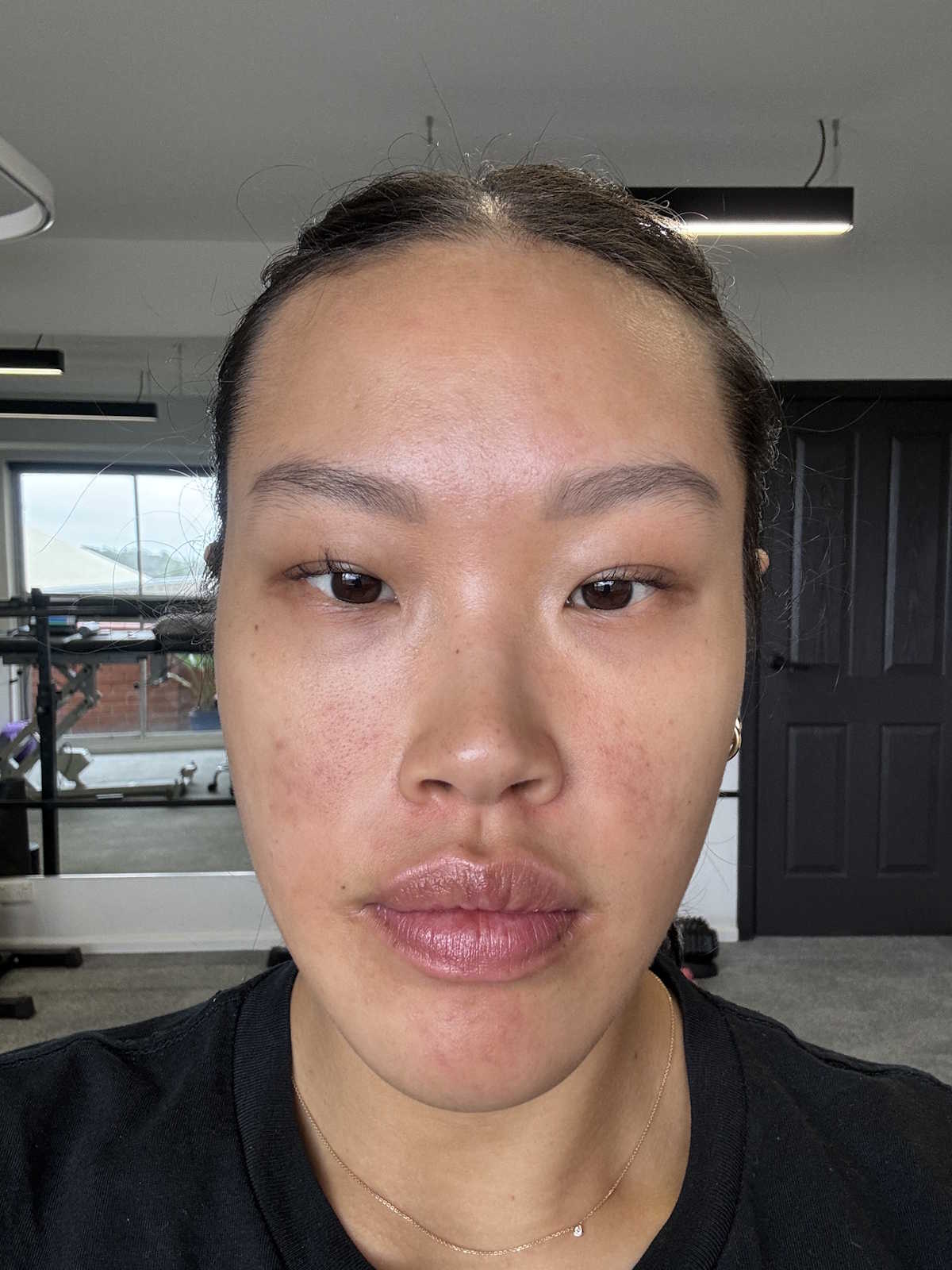AMPERNA-Betty-After.jpg