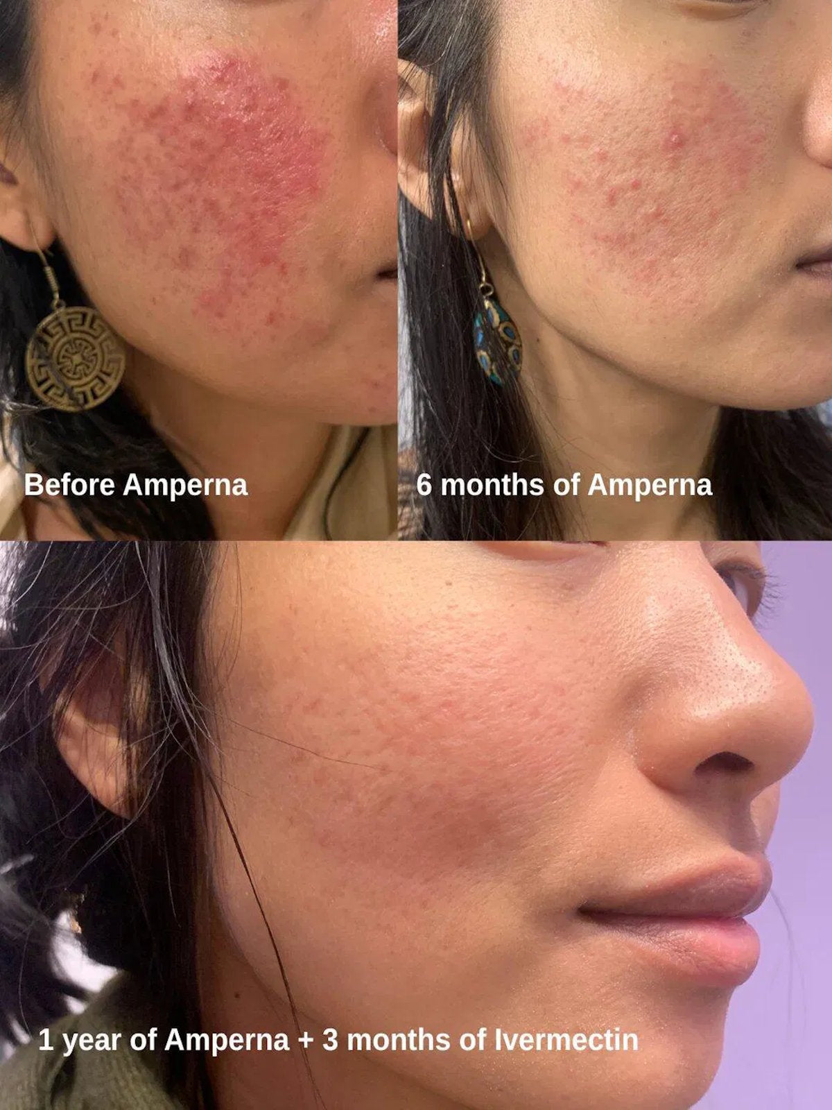 AMPERNA-Christina-Before-After.jpg