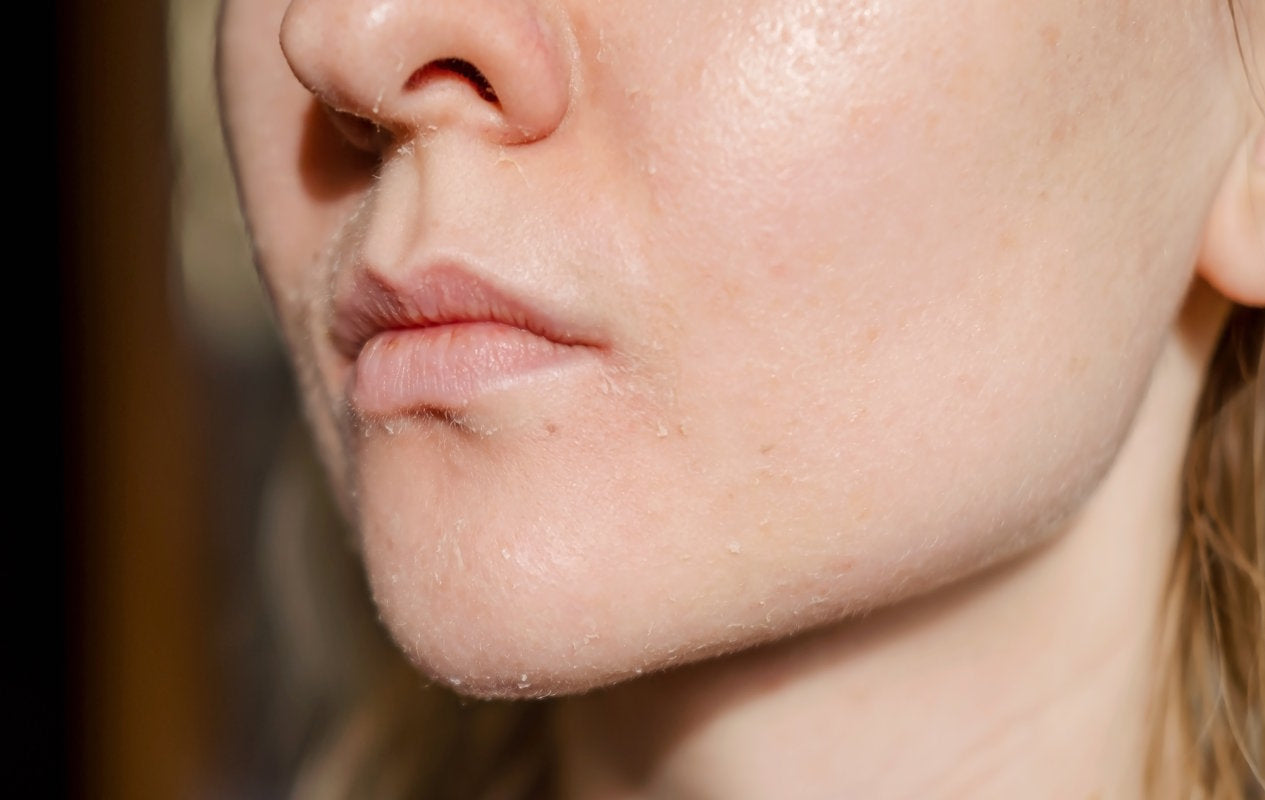 AMPERNA-Sensitive-Skin.jpg